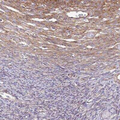 <b>Independent Antibodies Validation. </b>Immunohistochemistry: eEF-2 Antibody [NBP2-56755] - Immunohistochemical staining of human ovary shows stroma positivity.