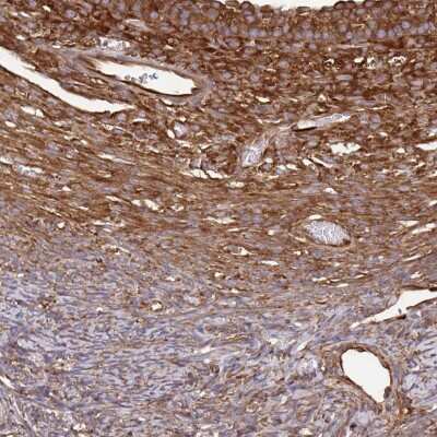 Immunohistochemistry-Paraffin: eEF-2 Antibody [NBP2-57792] - Immunohistochemical staining of human ovary shows stroma positivity.