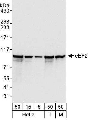 Western Blot: eEF-2 Antibody [NB100-87020] - Whole cell lysate from HeLa (5, 15 and 50 ug), 293T (T; 50 ug), and mouse NIH3T3 (M; 50 ug) cells. Antibody used at 0.04 ug/ml.