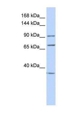 Western Blot: eEF-2 Antibody [NBP1-54383] - Titration: 0.2-1 ug/ml, Positive Control: Hela cell lysate.