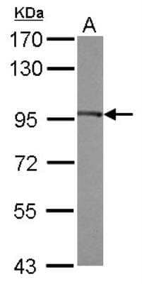 Western Blot: eEF-2 Antibody [NBP2-16274] - Sample (30 ug of whole cell lysate) A: MCF-7 7. 5% SDS PAGE gel, diluted at 1:1000.