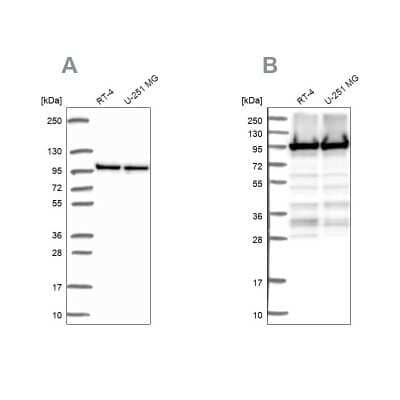 Western Blot: eEF-2 Antibody [NBP2-56755] - Analysis using Anti-EEF2 antibody NBP2-56755 (A) shows similar pattern to independent antibody NBP2-57792 (B).