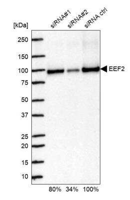 <b>Genetic Strategies Validation. </b>Western Blot: eEF-2 Antibody [NBP2-57792] - Analysis in U2OS cells transfected with control siRNA, target specific siRNA probe #1 and #2. Remaining relative intensity is presented.