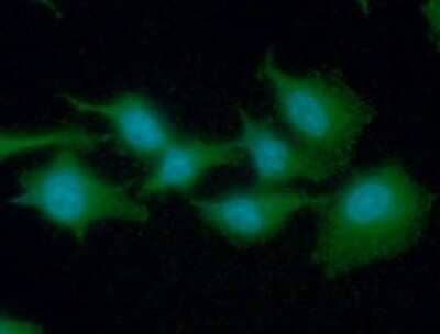 Immunocytochemistry/Immunofluorescence: eEF1A1 Antibody (23C11) [NBP2-59411] - Analysis of EEF1A1 in A549 cells line, stained with DAPI (Blue) for nucleus staining and monoclonal anti-human EEF1A1 antibody (1:100) with goat anti-mouse IgG-Alexa fluor 488 conjugate (Green).