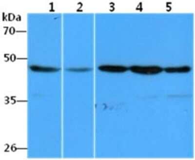 Western Blot: eEF1A1 Antibody (23C11) [NBP2-59411] - Lane 1: HeLa cell lysates, Lane 2: A549 cell lysates, Lane 3: Raji cell lysates, Lane 4: THP-1 cell lysates, Lane 5: MCF-7 cell lysates