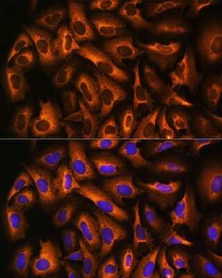 Immunocytochemistry/Immunofluorescence: eEF1A1 Antibody [NBP2-92598] - Immunofluorescence analysis of U2OS cells using eEF1A1 Rabbit pAb (NBP2-92598) at dilution of 1:100. Blue: DAPI for nuclear staining.