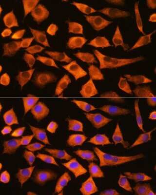 Immunocytochemistry/Immunofluorescence: eEF1A1 Antibody [NBP2-92598] - Immunofluorescence analysis of L929 cells using eEF1A1 Rabbit pAb (NBP2-92598) at dilution of 1:100. Blue: DAPI for nuclear staining.