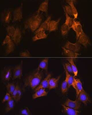 Immunocytochemistry/Immunofluorescence: eEF1A1 Antibody [NBP2-92598] - Immunofluorescence analysis of C6 cells using eEF1A1 Rabbit pAb (NBP2-92598) at dilution of 1:100. Blue: DAPI for nuclear staining.