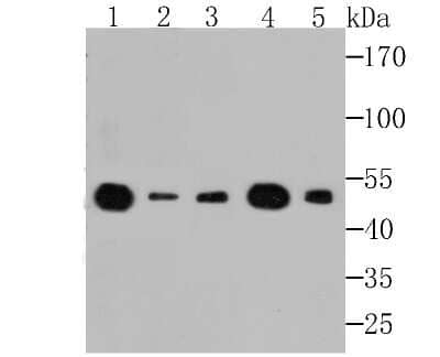 Western Blot: eEF1A1 Antibody (JB44-13) [NBP2-75478] - Analysis of eEF1A1 on different lysates using anti-eEF1A1 antibody at 1/500 dilution.Positive control:Lane 1: Rat brain tissueLane 2: Mouse skeletal muscleLane 3: Mouse cerebellumLane 4: Rat skin   Lane 5: Daudi