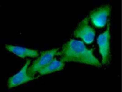 Immunocytochemistry/Immunofluorescence: eIF2 alpha/EIF2S1 Antibody (5E10) [NBP1-97936] - Analysis of EIF2S1 in HeLa cells line, stained with DAPI (Blue) for nucleus staining and monoclonal anti-human EIF2S1 antibody (1:100) with goat anti-mouse IgG-Alexa fluor 488 conjugate (Green). 