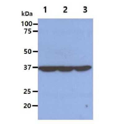 Western Blot: eIF2 alpha/EIF2S1 Antibody (5E10) [NBP1-97936] - The Cell lysates (40ug) were resolved by SDS-PAGE, transferred to PVDF membrane and probed with anti-human  EIF2S1 antibody (1:1000). Proteins were visualized using a goat anti-mouse secondary antibody conjugated to HRP and an ECL detection system.Lane 1.: HeLa cell lysateLane 2.: Jurkat cell lysate Lane 3.: NIH-3T3 cell lysate