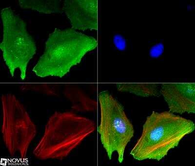 Immunocytochemistry/Immunofluorescence: eIF2A Antibody (3A7B11) [NBP2-26296] - eIF2A antibody (1:50) was tested in HeLa cells with Dylight 488 (green). Nuclei and alpha-tubulin were counterstained with DAPI (blue) and Dylight 550 (red). Image objective 40x.