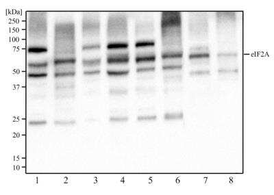 Western Blot: eIF2A Antibody (3A7B11) [NBP2-26296] - Western blot analysis of HeLa (1), NIH3T3 (2), A431 (3), MCF-7 (4), Ntera2 (5), PC12 (6), HepG2 (7), and Cos7 (8) cell lysate using eIF2A antibody at a concentration of 2 ug/ml.