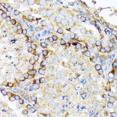 Immunohistochemistry-Paraffin: eIF2A Antibody (8V8H7) [NBP3-16864] - Immunohistochemistry of paraffin-embedded mouse testis using eIF2A Rabbit mAb (NBP3-16864) at dilution of 1:100 (40x lens).Perform microwave antigen retrieval with 10 mM Tris/EDTA buffer pH 9.0 before commencing with IHC staining protocol.