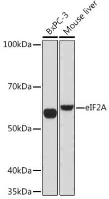 Western Blot: eIF2A Antibody (8V8H7) [NBP3-16864] - Western blot analysis of extracts of various cell lines, using eIF2A Rabbit mAb (NBP3-16864) at 1:1000 dilution. Secondary antibody: HRP Goat Anti-Rabbit IgG (H+L) at 1:10000 dilution. Lysates/proteins: 25ug per lane. Blocking buffer: 3% nonfat dry milk in TBST. Detection: ECL Basic Kit. Exposure time: 90s.