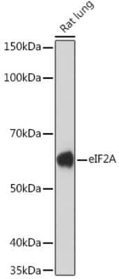 Western Blot: eIF2A Antibody (8V8H7) [NBP3-16864] - Western blot analysis of extracts of Rat lung, using eIF2A Rabbit mAb (NBP3-16864) at 1:1000 dilution. Secondary antibody: HRP Goat Anti-Rabbit IgG (H+L) at 1:10000 dilution. Lysates/proteins: 25ug per lane. Blocking buffer: 3% nonfat dry milk in TBST. Detection: ECL Enhanced Kit. Exposure time: 3min.