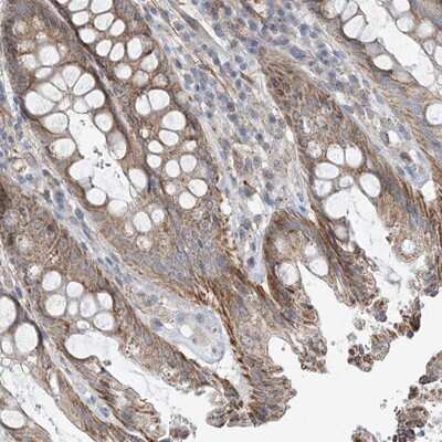 Immunohistochemistry-Paraffin: eIF2A Antibody [NBP1-84879] - Staining of human rectum shows moderate cytoplasmic positivity in glandular cells.