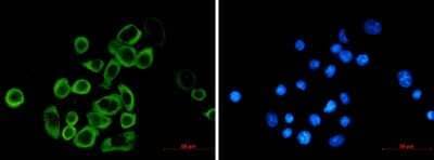 Immunocytochemistry/Immunofluorescence: eIF2A Antibody (S08-8E2) [NBP3-14927] - Immunofluorescence of eIF2A (green) in MCF-7 using eIF2A antibody at dilution 1/20, and DAPI (blue)