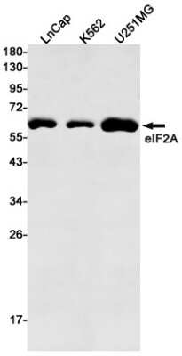 Western Blot: eIF2A Antibody (S08-8E2) [NBP3-14927] - Western blot detection of eIF2A in LnCap, K562, U251MG cell lysates using eIF2A Rabbit mAb (1:500 diluted). Predicted band size: 65kDa. Observed band size: 65kDa.