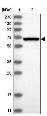 Western Blot: eIF2A Antibody [NBP1-84879] - Lane 1: Marker  [kDa] 230, 130, 95, 72, 56, 36, 28, 17, 11.  Lane 2: Human cell line RT-179