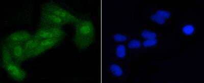 Immunocytochemistry/Immunofluorescence: eIF2A [p Ser51] Antibody (SZ01-06) [NBP2-67353] - Staining of Hela cells (green) using NBP2-67353. The nuclear counter stain is DAPI (blue). Cells were fixed in paraformaldehyde, permeabilised with 0.25% Triton X100/PBS.