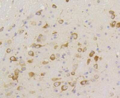 Immunohistochemistry-Paraffin: eIF2A [p Ser51] Antibody (SZ01-06) [NBP2-67353] - Analysis of paraffin-embedded mouse brain tissue using anti-Phospho-eIF-2a(S51) antibody. Counter stained with hematoxylin.