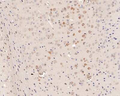 Immunohistochemistry-Paraffin: eIF2A [p Ser51] Antibody (SZ01-06) [NBP2-67353] - Analysis of paraffin-embedded mouse brain tissue with Rabbit anti-eIF2A [p Ser51] antibody washed with ddH2O and PBS, and then probed with the primary antibody  at 1/200 dilution for 1 hour at room temperature. The detection was performed using an HRP conjugated compact polymer system. DAB was used as the chromogen. Tissues were counterstained with hematoxylin and mounted with DPX.