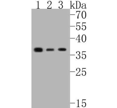 Western Blot: eIF2A [p Ser51] Antibody (SZ01-06) [NBP2-67353] - Analysis of Phospho-eIF-2a(S51) on different lysates. Proteins were transferred to a PVDF membrane and blocked with 5% BSA in PBS for 1 hour at room temperature. The primary antibody (1/500) was used in 5% BSA at room temperature for 2 hours. Goat Anti-Rabbit IgG - HRP Secondary Antibody  at 1:5,000 dilution was used for 1 hour at room temperature.Positive control: Lane 1: HUVEC cell lysateLane 2: Hela cell lysateLane 2: PC-3M cell lysate