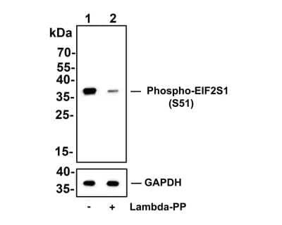 Western Blot: eIF2A [p Ser51] Antibody (SZ01-06) [NBP2-67353] - Analysis of eIF2A [p Ser51] on THP-1 cell lysates. Lane 1: THP-1 cells, whole cell lysate, 10ug/lane Lane 2: THP-1 cells treated with 2.8ug/ul lambda-PP for 30 minutes, whole cell lysates, 10ug/lane All lanes : Anti-eIF2A [p Ser51]antibody at 1/500 dilution. Anti-GAPDH antibody at 1/10,000 dilution. Goat Anti-Rabbit IgG H&L (HRP) at 1/200,000 dilution. Predicted band size: 36 kDa Observed band size: 36 kDa Blocking and diluting buffer: 5% BSA. Exposure time: 3 minutes 43 seconds