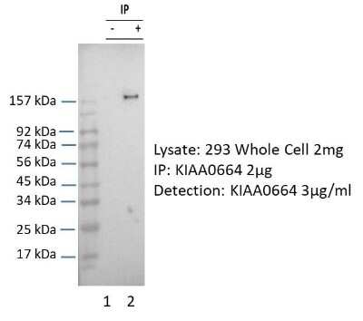 Immunoprecipitation: eIF3X Antibody [NBP2-87345] - KIAA0664 was immunoprecipitated from 1 mg HEK293 Whole Cell Lysate with NBP2-87345 with 1:200 dilution. Western blot was performed using NBP2-87345 at 1/1000 dilution.. Lane 1: Control IP in HEK293 Whole Cell Lysate. Lane 2: KIAA0664 IP