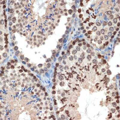 Immunohistochemistry-Paraffin: eIF3e Antibody (3H4N2) [NBP3-16184] - Immunohistochemistry of paraffin-embedded mouse testis using eIF3e Rabbit mAb (NBP3-16184) at dilution of 1:100 (40x lens).Perform microwave antigen retrieval with 10 mM Tris/EDTA buffer pH 9.0 before commencing with IHC staining protocol.