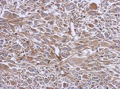 Immunohistochemistry-Paraffin: eIF3e Antibody [NBP2-16298] - C2C12 xenograft, using eIF3e  antibody at 1:500 dilution. Antigen Retrieval: TrilogyTM (EDTA based) buffer, 15min