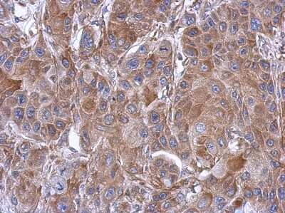 Immunohistochemistry-Paraffin: eIF3e Antibody [NBP2-16298] - Cal27 xenograft, using antibody at 1:500 dilution. Antigen Retrieval: TrilogyTM (EDTA based) buffer, 15min