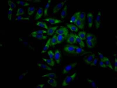 Immunocytochemistry/Immunofluorescence: eIF4A1 Antibody (7C3) [NBP3-15220] - Immunofluorescence staining of Hela Cells with at eIF4A1 antibody 1:50, counter-stained with DAPI. The cells were fixed in 4% formaldehyde, permeated by 0.2% TritonX-100, and blocked in 10% normal Goat Serum. The cells were then incubated with the antibody overnight at 4C. Nuclear DNA was labeled in blue with DAPI. The secondary antibody was FITC-conjugated Goat Anti-Rabbit IgG (H+L).