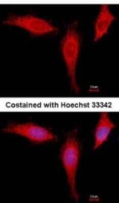 Immunocytochemistry/Immunofluorescence: eIF4A1 Antibody [NBP2-16302] - Analysis of methanol-fixed HeLa, using antibody at 1:500 dilution.