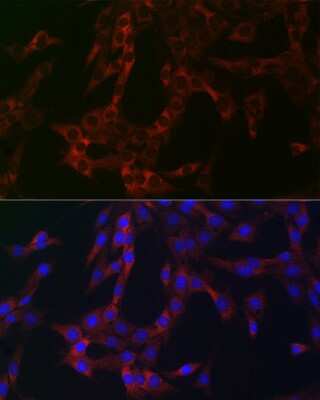 Immunocytochemistry/Immunofluorescence: eIF4A1 Antibody [NBP3-04718] - Immunofluorescence analysis of C6 cells using eIF4A1 Rabbit pAb (NBP3-04718) at dilution of 1:100 (40x lens). Blue: DAPI for nuclear staining.