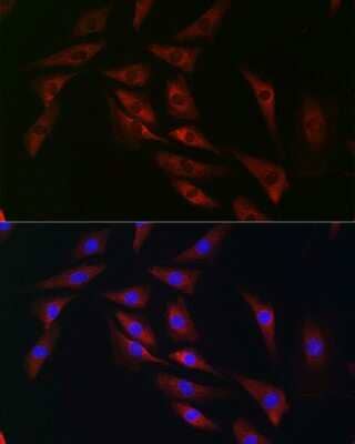 Immunocytochemistry/Immunofluorescence: eIF4A1 Antibody [NBP3-04718] - Immunofluorescence analysis of NIH/3T3 cells using eIF4A1 Rabbit pAb (NBP3-04718) at dilution of 1:100 (40x lens). Blue: DAPI for nuclear staining.