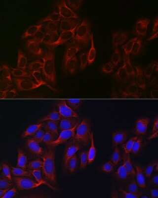 Immunocytochemistry/Immunofluorescence: eIF4A1 Antibody [NBP3-04718] - Immunofluorescence analysis of U2OS cells using eIF4A1 Rabbit pAb (NBP3-04718) at dilution of 1:100 (40x lens). Blue: DAPI for nuclear staining.