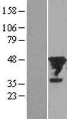 Western Blot: eIF4A1 Overexpression Lysate (Adult Normal) [NBL1-10201] Left-Empty vector transfected control cell lysate (HEK293 cell lysate); Right -Over-expression Lysate for eIF4A1.