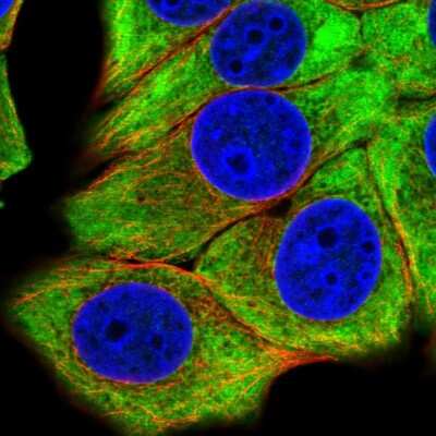 Immunocytochemistry/Immunofluorescence: eIF4B Antibody [NBP2-54943] - Staining of human cell line MCF7 shows localization to cytosol.