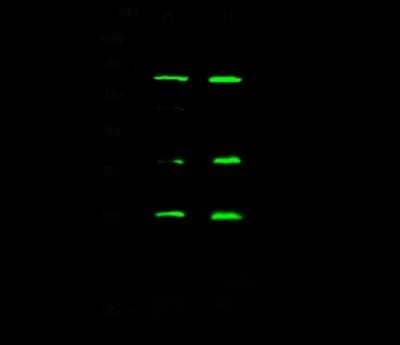 Western Blot: eIF4E Antibody [NBP2-98868] - Anti-eIF4E rabbit polyclonal antibody at 1:500 dilution. Lane A: Jurkat Whole Cell Lysate. Lane B: K562 Whole Cell Lysate. Lysates/proteins at 30 ug per lane. Secondary Goat Anti- Rabbit  IgG H&L (Dylight 800)  at 1/10000 dilution. Developed using the Odyssey technique. Performed under reducing conditions. Predicted band size: 25 kDa. Observed band size: 25 kDa (We are unsure as to the identity of these extra bands).