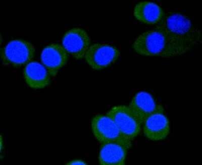 Immunocytochemistry/Immunofluorescence: eIF4E [p Ser209] Antibody (SU0396) [NBP2-66802] - Staining Phospho-eIF4E(S209) in N2A cells (green). The nuclear counter stain is DAPI (blue). Cells were fixed in paraformaldehyde, permeabilised with 0.25% Triton X100/PBS.