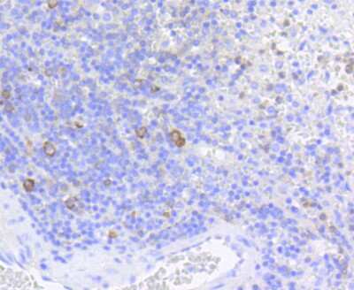 Immunohistochemistry-Paraffin: eIF4E [p Ser209] Antibody (SU0396) [NBP2-66802] - Analysis of paraffin-embedded human spleen tissue using anti-Phospho-eIF4E(S209) antibody. Counter stained with hematoxylin.