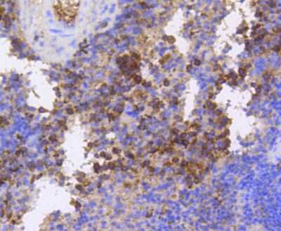 Immunohistochemistry-Paraffin: eIF4E [p Ser209] Antibody (SU0396) [NBP2-66802] - Analysis of paraffin-embedded mouse spleen tissue using anti-Phospho-eIF4E(S209) antibody. Counter stained with hematoxylin.