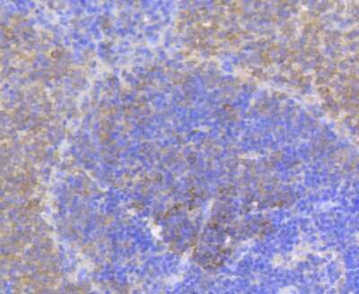 Immunohistochemistry-Paraffin: eIF4E [p Ser209] Antibody (SU0396) [NBP2-66802] - Analysis of paraffin-embedded rat spleen tissue using anti-Phospho-eIF4E(S209) antibody. Counter stained with hematoxylin.