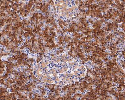 Immunohistochemistry-Paraffin: eIF4E [p Ser209] Antibody (SU0396) [NBP2-66802] - Analysis of paraffin-embedded human pancreas tissue with Rabbit anti-Phospho-eIF4E (S209) antibody washed with ddH2O and PBS, and then probed with the primary antibody  at 1/200 dilution for 1 hour at room temperature. The detection was performed using an HRP conjugated compact polymer system. DAB was used as the chromogen. Tissues were counterstained with hematoxylin and mounted with DPX.