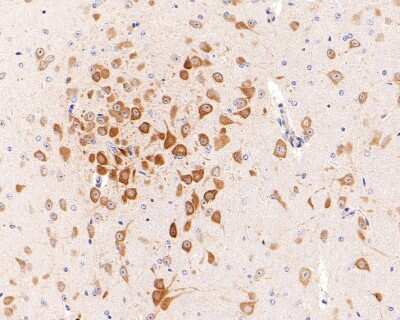 Immunohistochemistry-Paraffin: eIF4E [p Ser209] Antibody (SU0396) [NBP2-66802] - Analysis of paraffin-embedded mouse brain tissue with Rabbit anti-Phospho-eIF4E (S209) antibody washed with ddH2O and PBS, and then probed with the primary antibody at 1/200 dilution for 1 hour at room temperature. The detection was performed using an HRP conjugated compact polymer system. DAB was used as the chromogen. Tissues were counterstained with hematoxylin and mounted with DPX.