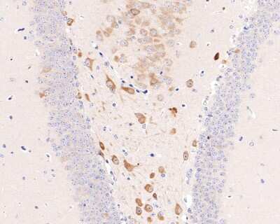 Immunohistochemistry-Paraffin: eIF4E [p Ser209] Antibody (SU0396) [NBP2-66802] - Analysis of paraffin-embedded mouse hippocampus tissue with Rabbit anti-Phospho-eIF4E (S209) antibody washed with ddH2O and PBS, and then probed with the primary antibody  at 1/200 dilution for 1 hour at room temperature. The detection was performed using an HRP conjugated compact polymer system. DAB was used as the chromogen. Tissues were counterstained with hematoxylin and mounted with DPX.