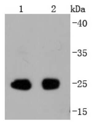 Western Blot: eIF4E [p Ser209] Antibody (SU0396) [NBP2-66802] - Analysis of Phospho-eIF4E(S209) on different lysates using anti-Phospho-eIF4E(S209) antibody at 1/1,000 dilution. Positive control: Lane 1: Mouse spleen Lane 2: Rat spleen
