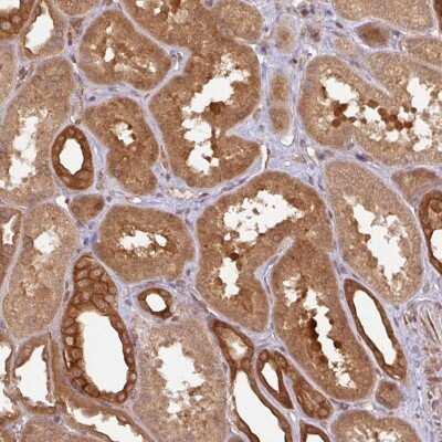 Immunohistochemistry: eIF4EBP2 Antibody [NBP2-37886] - Staining of human kidney shows strong cytoplasmic and membranous positivity in cells in tubules.